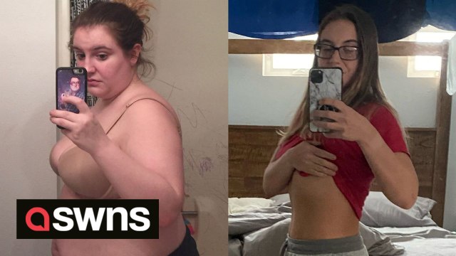 Mum's misshapen heart tattoo which looked like Olaf removed during skin removal surgery after she lost 10st