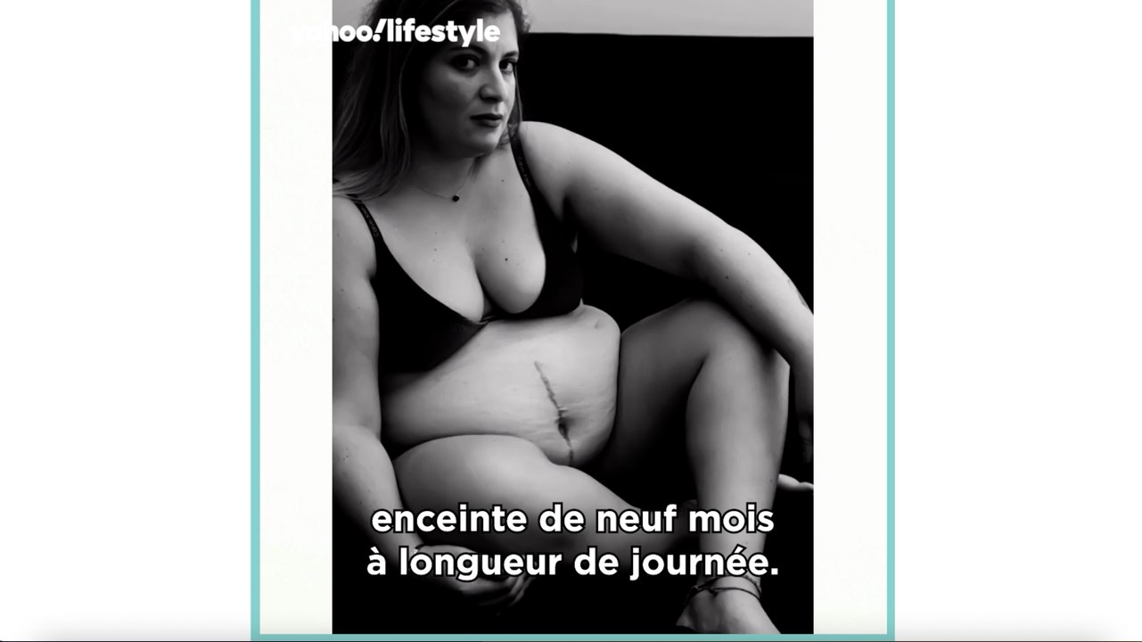 Chirurgie esthétique, à la vie à la mort : "Il m'a dit 'On ne peut pas rester comme ça. C’est grave, il faut opérer rapidement'"