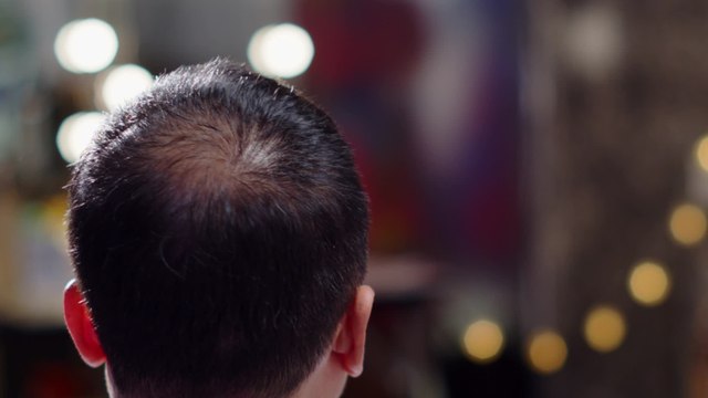 Study suggests drinking this could cause premature hair loss