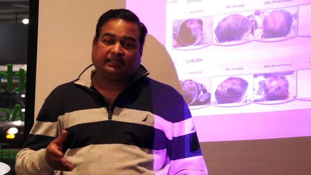 kishore case study - Australian Hair and Scalp Clinic Client2