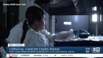 Cervical cancer cases rising among young women