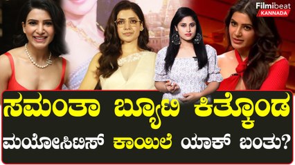 ಮಯೋಸಿಟಿಸ್ ಅಂದ್ರೇನು?ಈ ಕಾಯಿಲೆಯಿಂದ ಸಮಂತಾ ಜೀವನಪರ್ಯಂತ ನೋವು ಅನುಭವಿಸ್ಬೇಕಾ? | Filmibeat Kannada