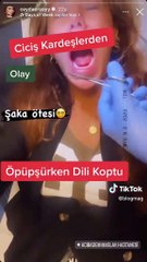 Mujer tuvo que operarse la lengua porque su cita la mordió muy fuerte