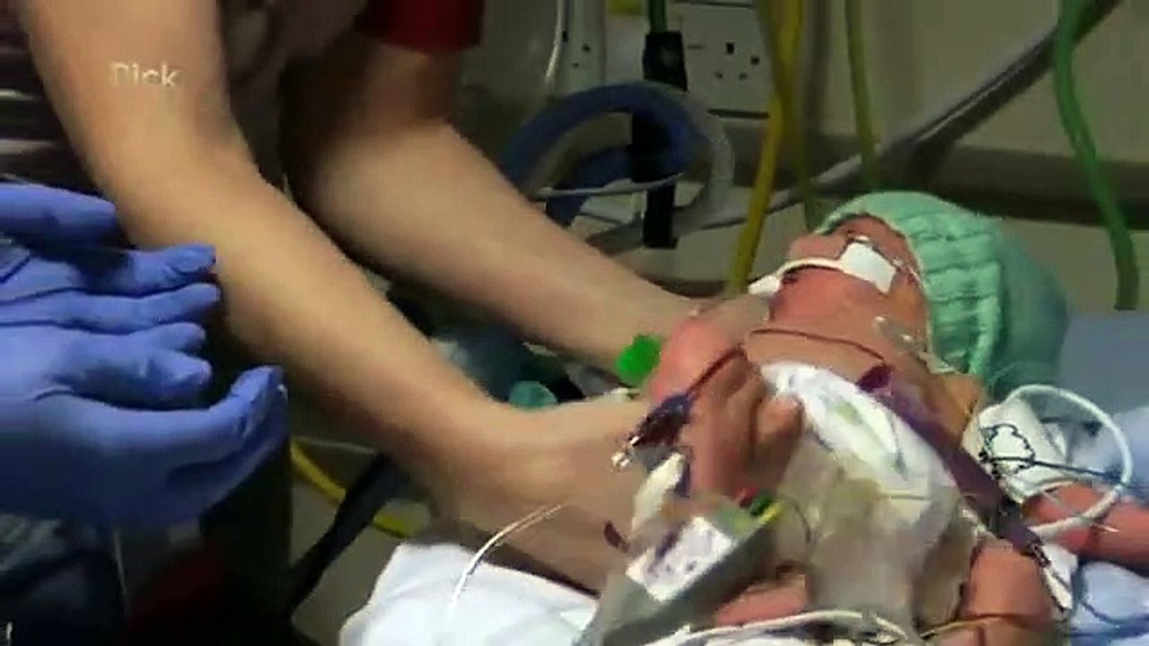 Childrens Accident And Emergency - Se2 - Ep01 HD Watch