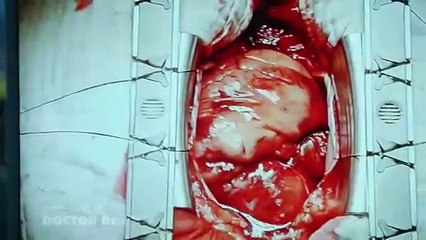 Doctor Doctor - Se1 - Ep06 HD Watch