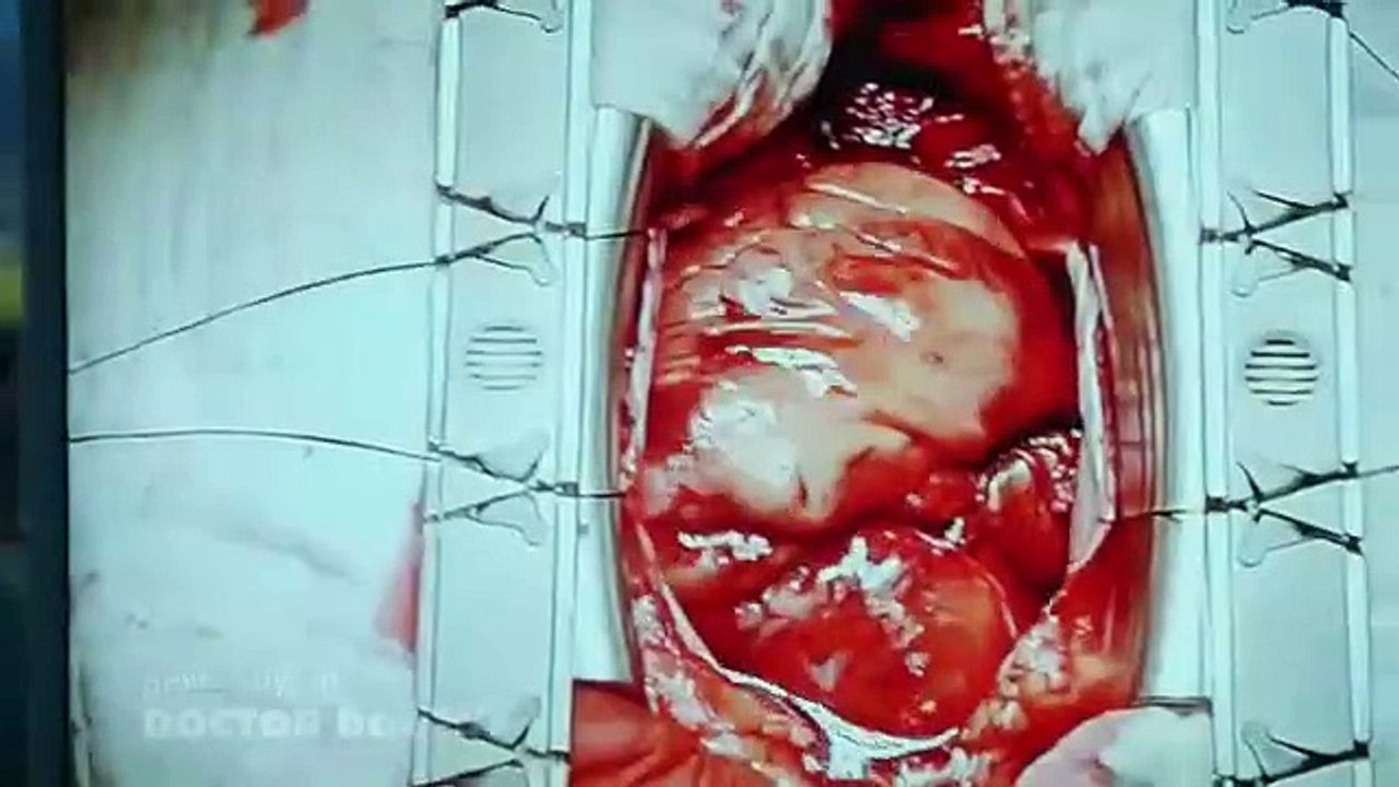 Doctor Doctor - Se1 - Ep06 HD Watch