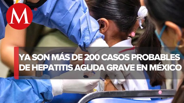 Hay 226 casos probables de hepatitis aguda grave de origen desconocido en niños de México