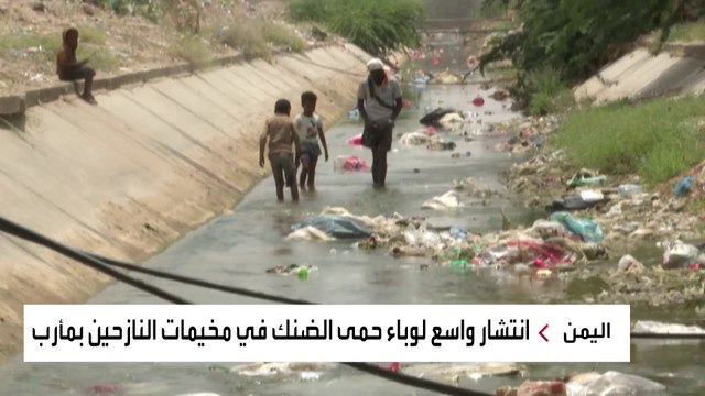 انتشار واسع لوباء حمى الضنك في مخيمات النازحين بمأرب