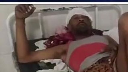 सीधी: दो बाइक चालकों की आमने-सामने हुई जोरदार भिड़ंत, एक व्यक्ति हुआ घायल