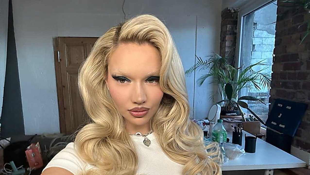 So sehr hat sich Shirin David durch OPs verändert