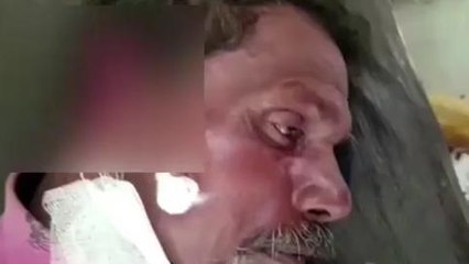 अयोध्या: अगर आप राम नगरी में हैं तो इनसे रहे सख्त सावधान नहीं तो कर सकते हैं जख्मी...