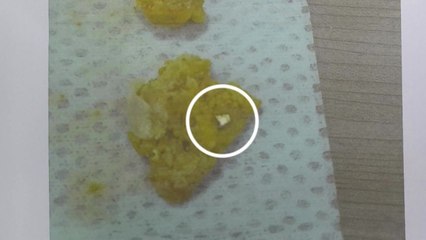 "빵 먹다 이 다쳤다" 거짓 협박...50대 악성 소비자 구속 / YTN