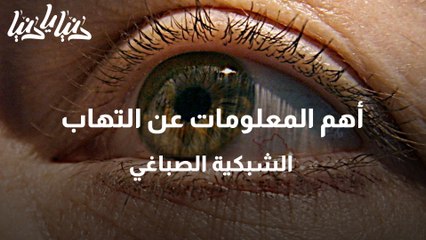 أهم المعلومات عن التهاب الشبكية الصباغي