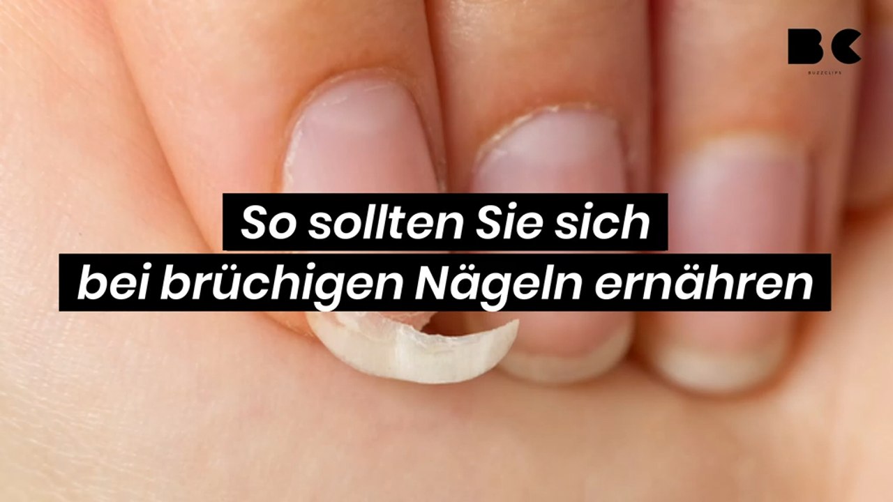 So sollten Sie sich bei brüchigen Nägeln ernähren