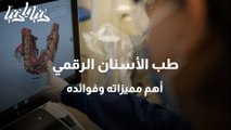 طب الأسنان الرقمي .. أهم مميزاته وفوائده