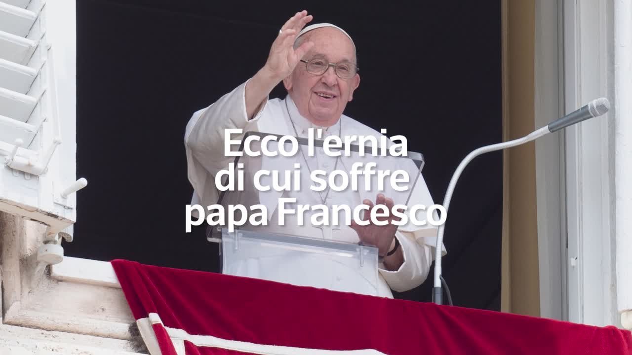 Ecco l'ernia di cui soffre papa Francesco