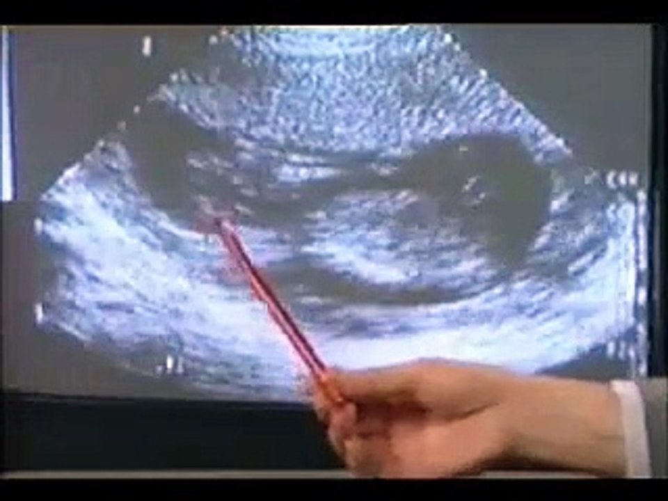呢個係第二部分（完整版02.粵語）. MP4