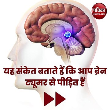 Symptoms of brain tumor : यह संकेत बताते हैं कि आप ब्रेन ट्यूमर से पीड़ित हैं