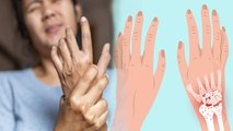 कलाई में सूजन क्यों होता है | Kalai Me Sujan Kyu Hota Hai | Wrist Swelling Reason In Hindi | Boldsky