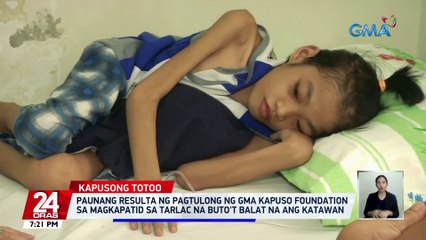 Télécharger la video: Paunang resulta ng pagtulong ng GMA Kapuso Foundation sa magkapatid sa Tarlac na buto't balat na ang katawan | 24 Oras