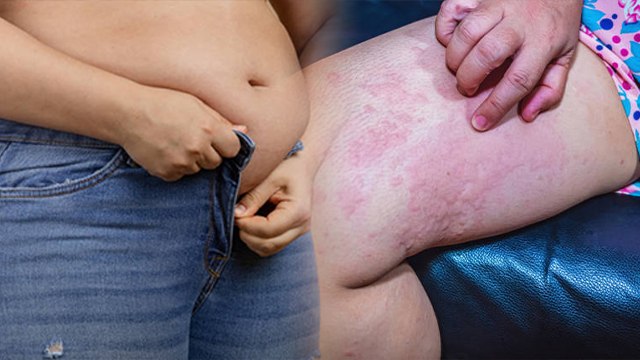 टाइट जींस पहनने से क्या होता है | Tight Jeans Pahenne Se Kya Hota Hai | Boldsky