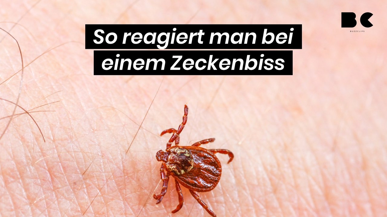 So reagiert man bei einem Zeckenbiss