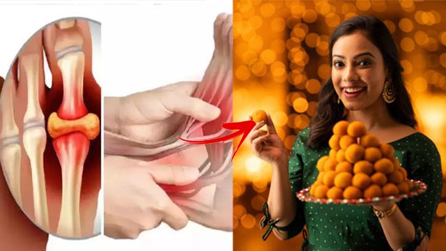 मीठा खाने से यूरिक एसिड बढ़ता है क्या | Mitha Khane Se Uric Acid Badhta Hai Kya| Boldsky