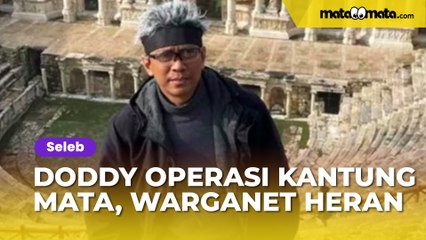 Doddy Sudrajat Habiskan Rp40 Juta untuk Operasi Kantung Mata, Hasilnya Bikin Warganet Heran: Gak Ada Bedanya!