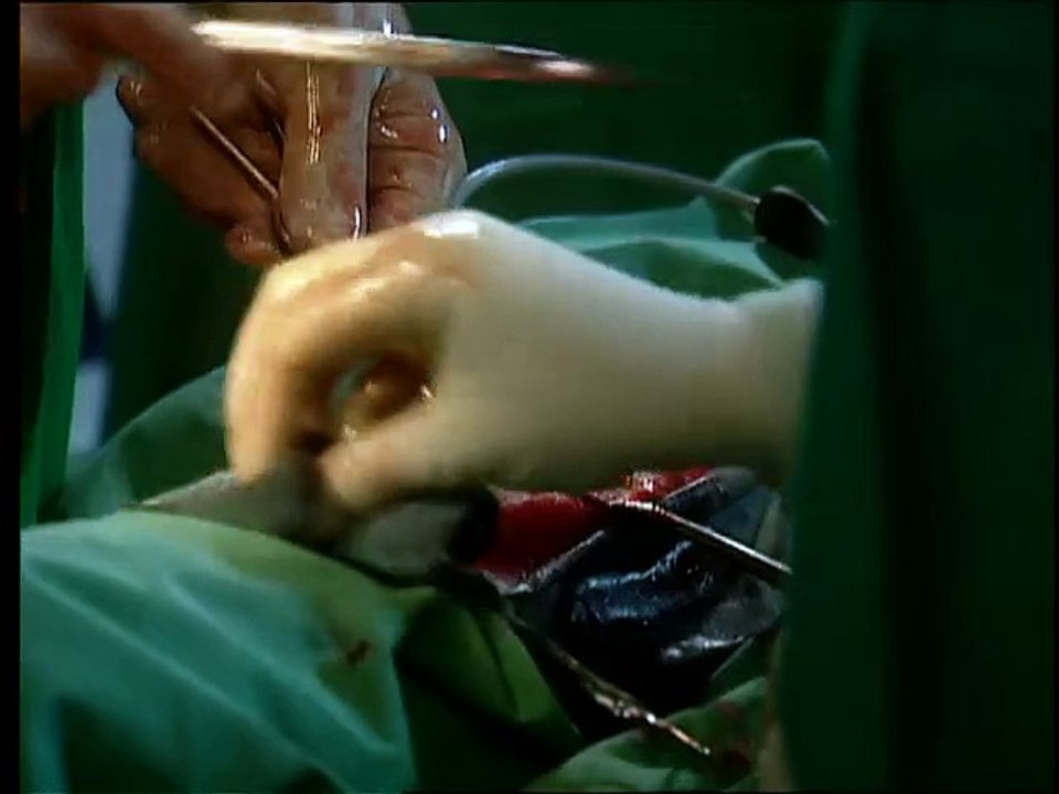 Alphateam - Die Lebensretter im OP Staffel 10 Folge 18