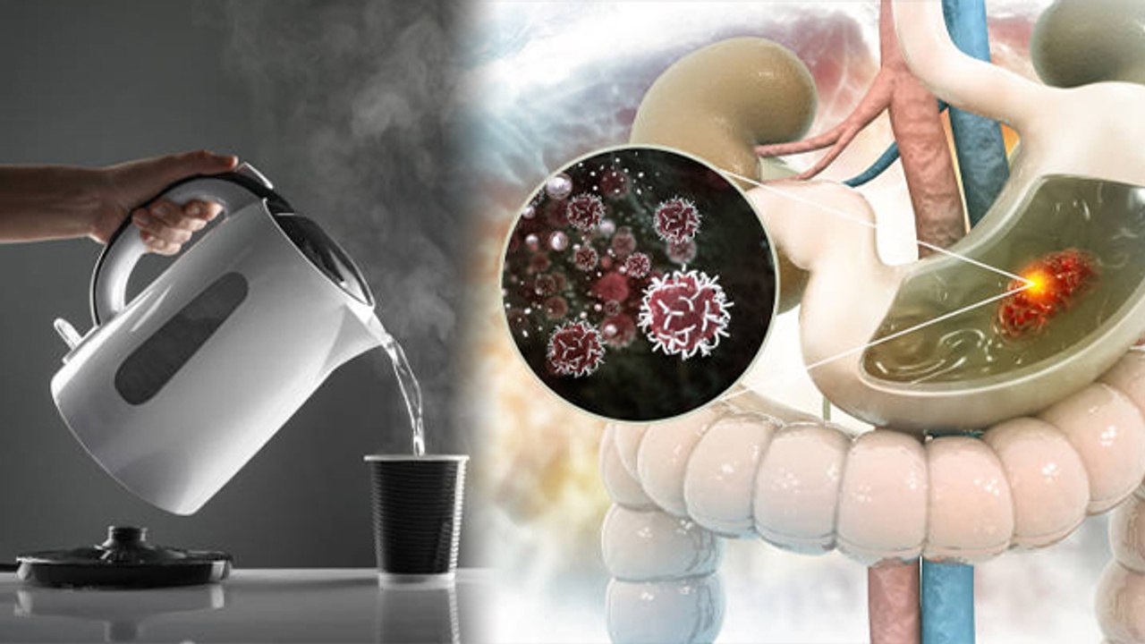 गरम पानी पीने से गैस बनती है क्या | Garam Pani Pine Se Gas Banti Hai Kya | Boldsky *Health