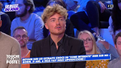 Robin, 21 ans, influenceur, revient sur ses multiples opérations de chirurgie esthétique