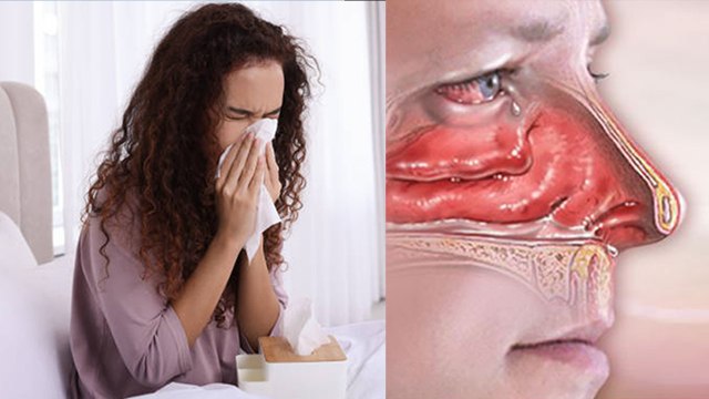 सुबह उठते ही छींक क्यों आती है । सुबह उठते ही छींक आना इस गंभीर बीमारी का लक्षण । Boldsky *Health