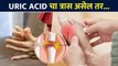 Uric Acid चा त्रास असेल तर हा व्हिडिओ नक्की बघा | How to Get Rid of Uric Acid Naturally Lokmat Sakhi