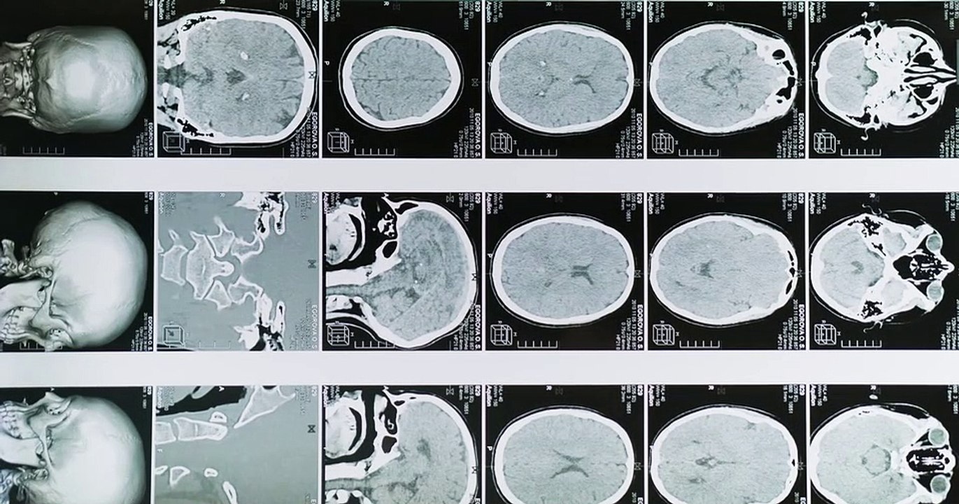 Cerebro humano
