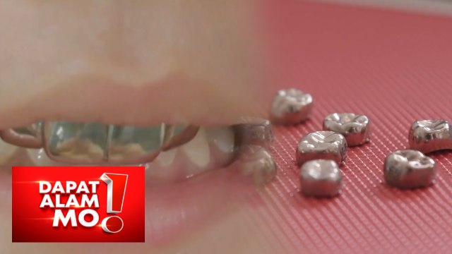 Stainless steel crowns, solusyon din laban sa maagang pagkabulok ng ngipin? | Dapat Alam Mo!