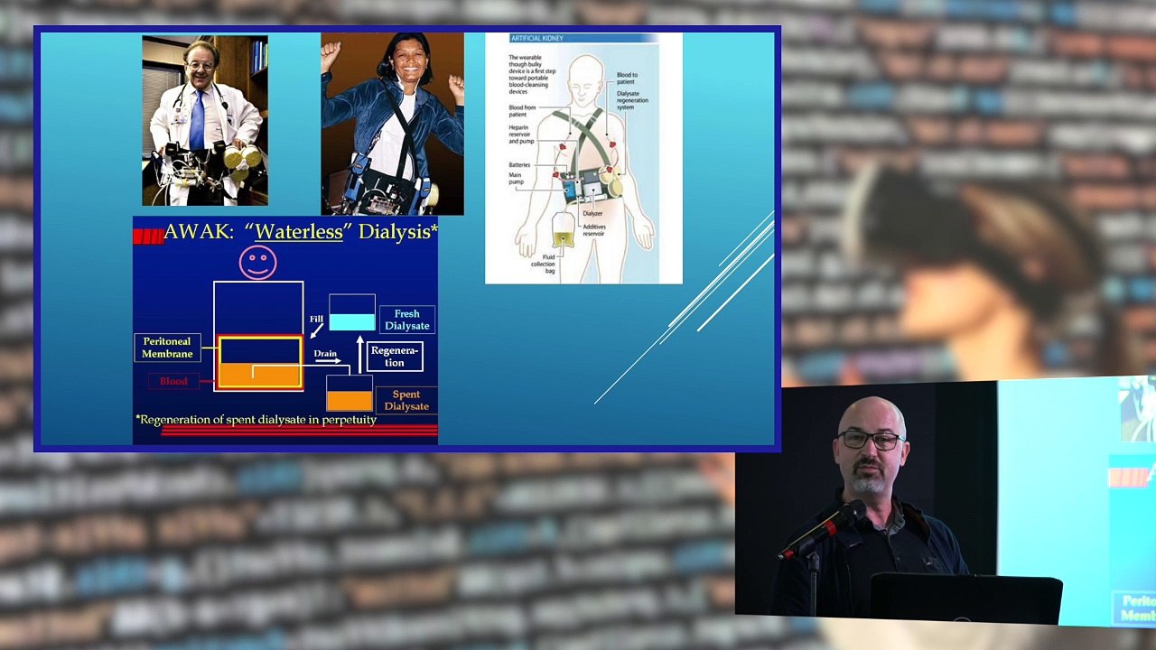 Intervention Dr G.Kosmadakis
