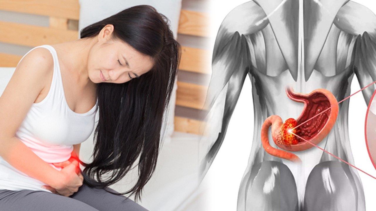 Gastric Cancer के शुरुआत में दिखते है ये लक्षण | Gastric Cancer Symptoms, जाने बचाव | Boldsky