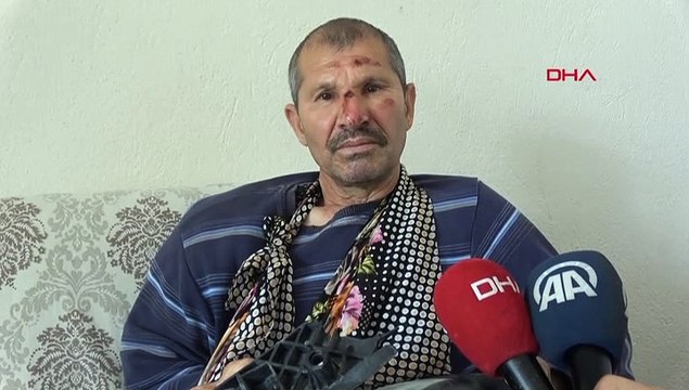 Kendisine çarpan aracın parçalarını sakladı! İnsan olan geçmiş olsun der