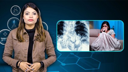 बार बार खांसी जुखाम क्यों होता है, खांसी जुखाम से दिमाग में कफ जमना | Boldsky *Health