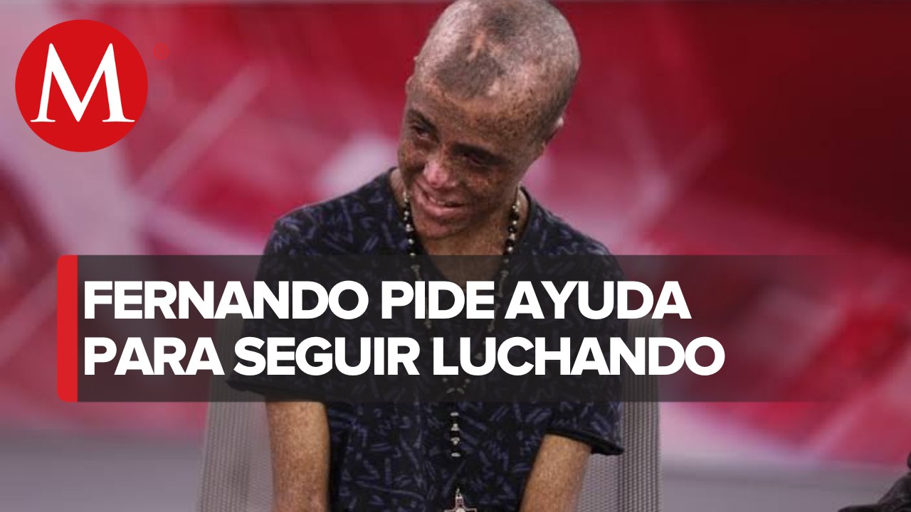 Fernando, un niño de 15 años lucha en contra de...