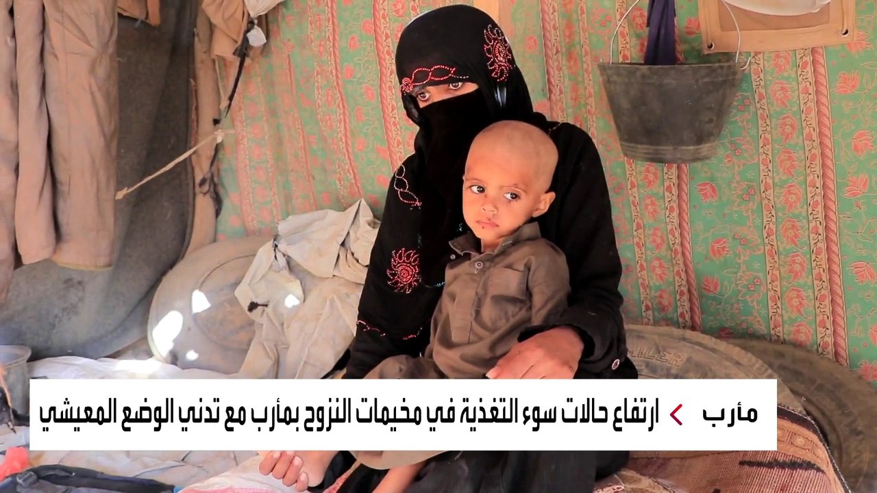 سوء التغذية يضرب مخيمات النازحين في مأرب
