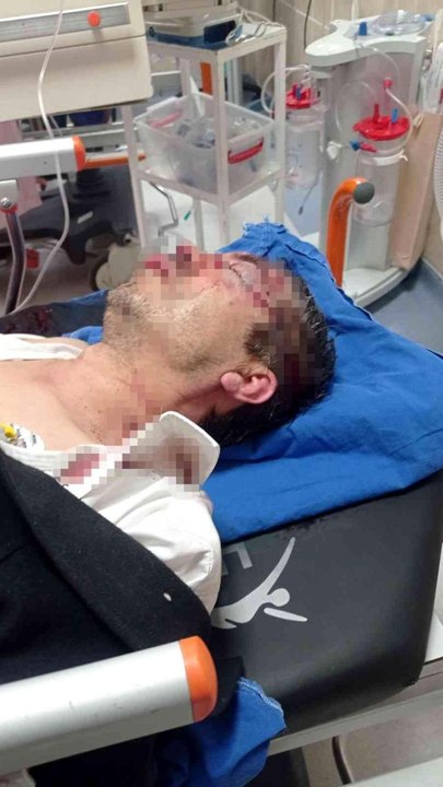 Sivas Ziraat Odası Sekreteri'ne saldırı