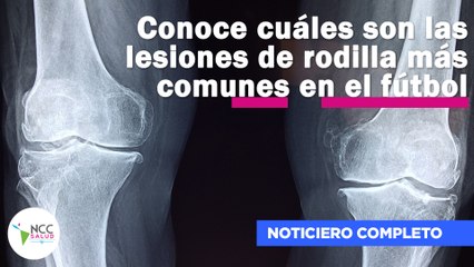 Video herunterladen: Conoce cuáles son las lesiones de rodilla más comunes en el fútbol |129| 23 al 29 de enero 2023