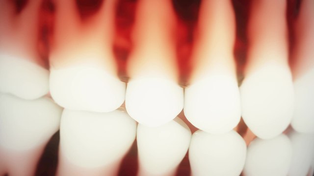 Worried about your wisdom teeth, this is when you should consider having them removed