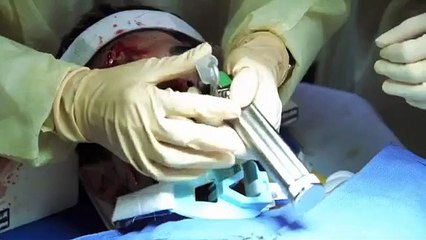 ER Season 8 Episode 7 - 'If I Should Fall from Grace' | Watch in HD