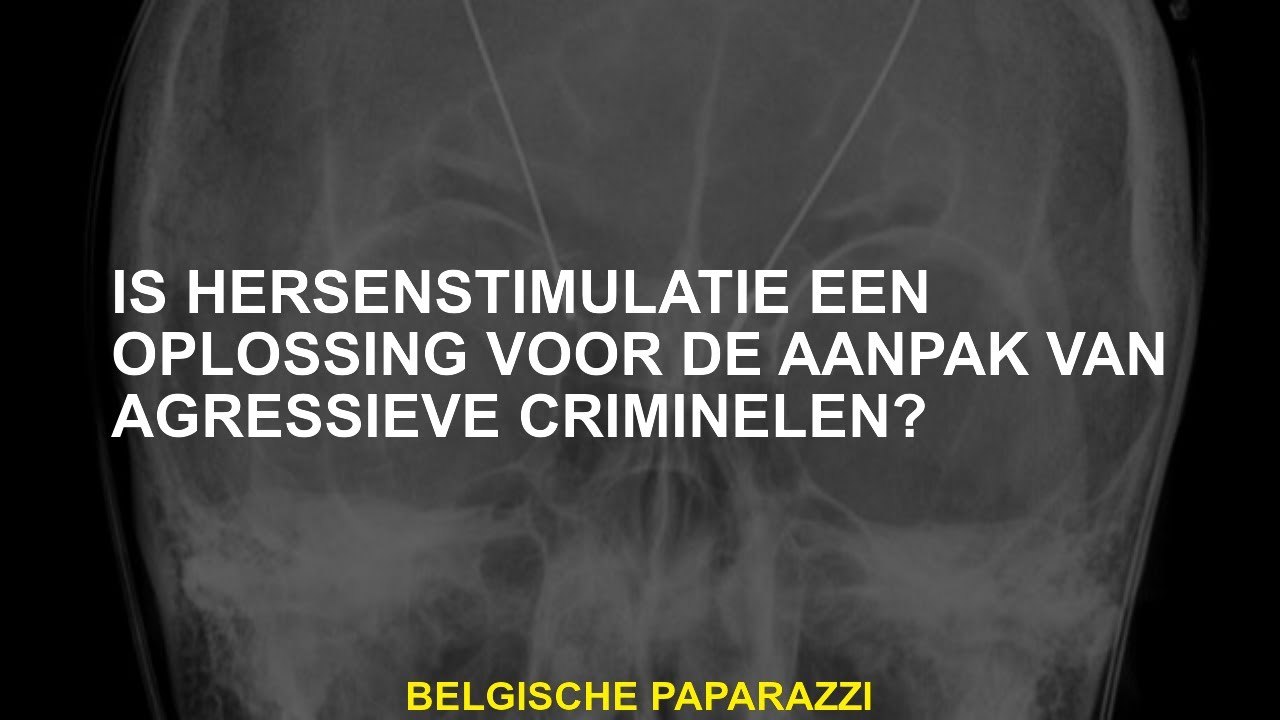 Is hersenstimulatie een oplossing voor het aanpakken van agressieve criminelen?