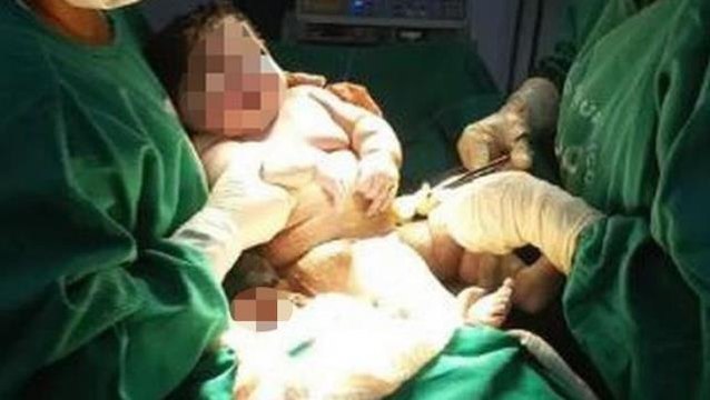 7 kilogram dünyaya gelen bebek doktorları bile şaşırttı! Yarım metreden fazla da boyu var