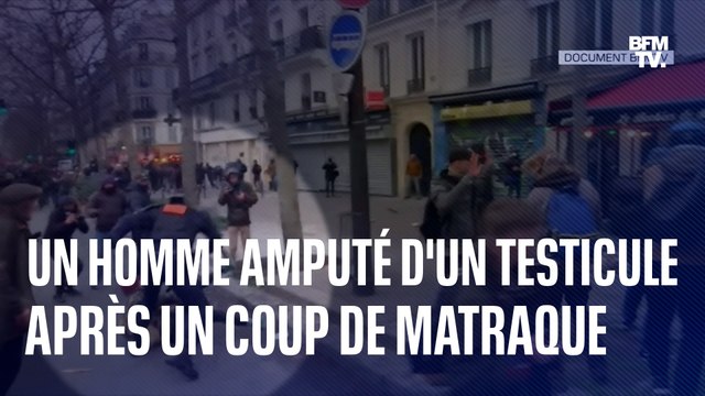 Manifestation du 19 janvier: un homme de 26 ans amputé d'un testicule après avoir reçu un coup de matraque d'un policier