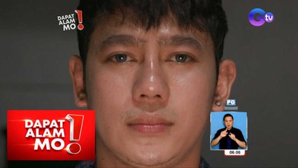 Palyadong rhinoplasty, puwede pa bang maremedyuhan? | Dapat Alam Mo!