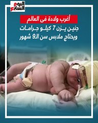 أغرب ولادة بالعالم.. جنين يزن 7 كيلوجرامات ويحتاج ملابس سن الـ9 شهور